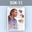 Плакат «Дисфункция височно-нижнечелюстного сустава» (ЗОЖ-33, пластик 2 мм, А2, 1 лист)